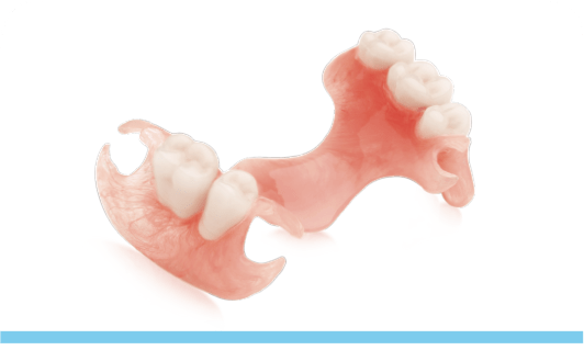 Detail Deflex Prothese Nomer 8