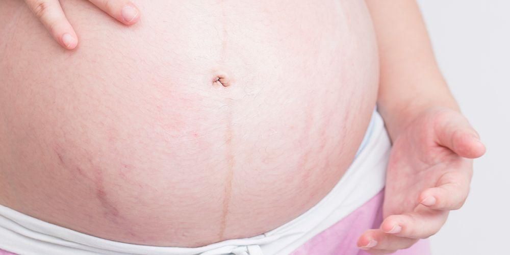 Detail Gambar Perut Ibu Hamil 4 Bulan Nomer 18