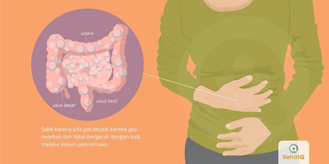 Detail Gambar Perut Kembung Nomer 3