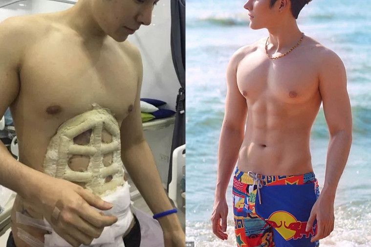 Detail Gambar Perut Six Pack Nomer 38