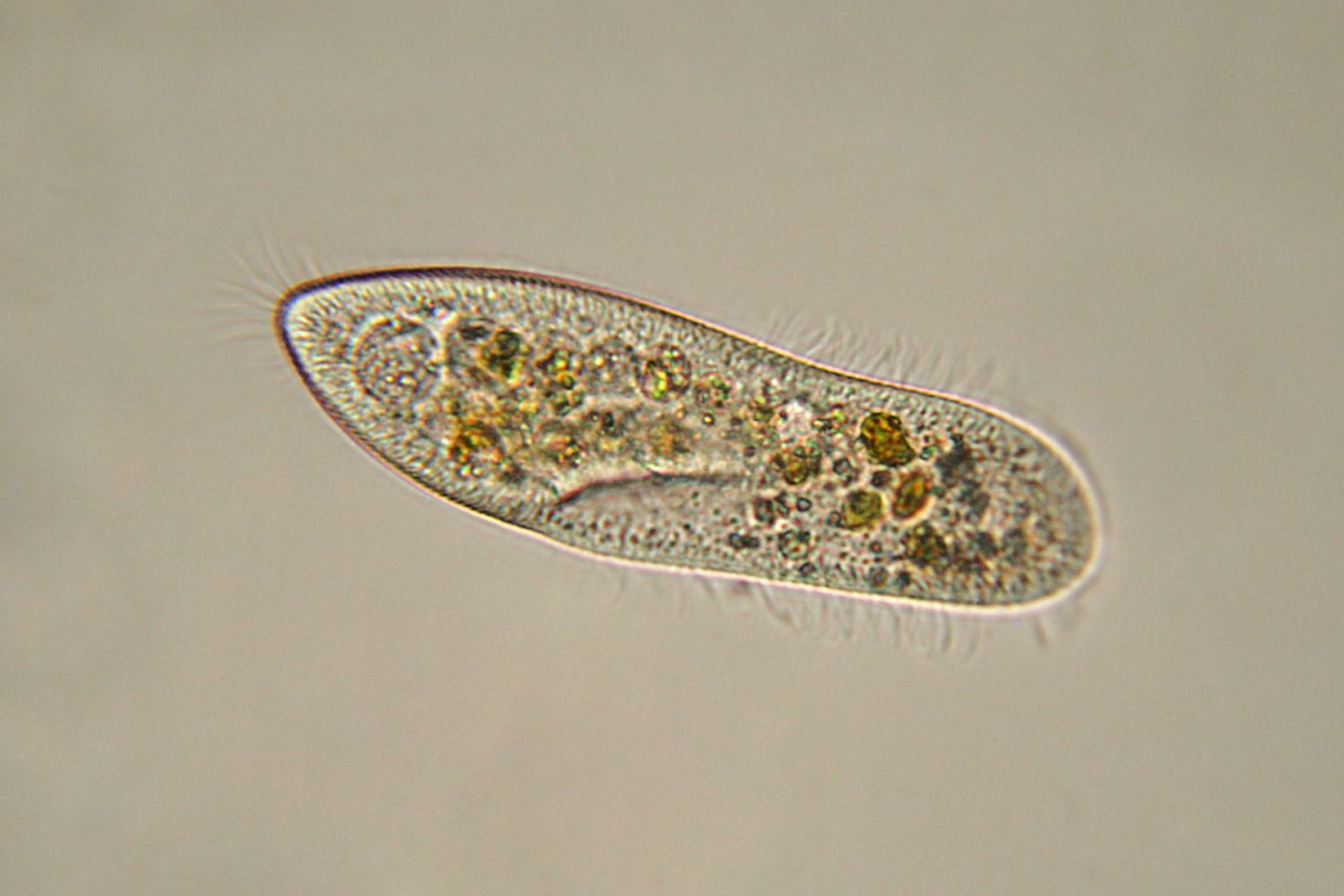 Detail Gambar Pictures Of Protista Nomer 5