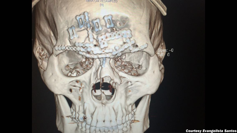 Detail Cyborg Skull X Ray Nomer 3