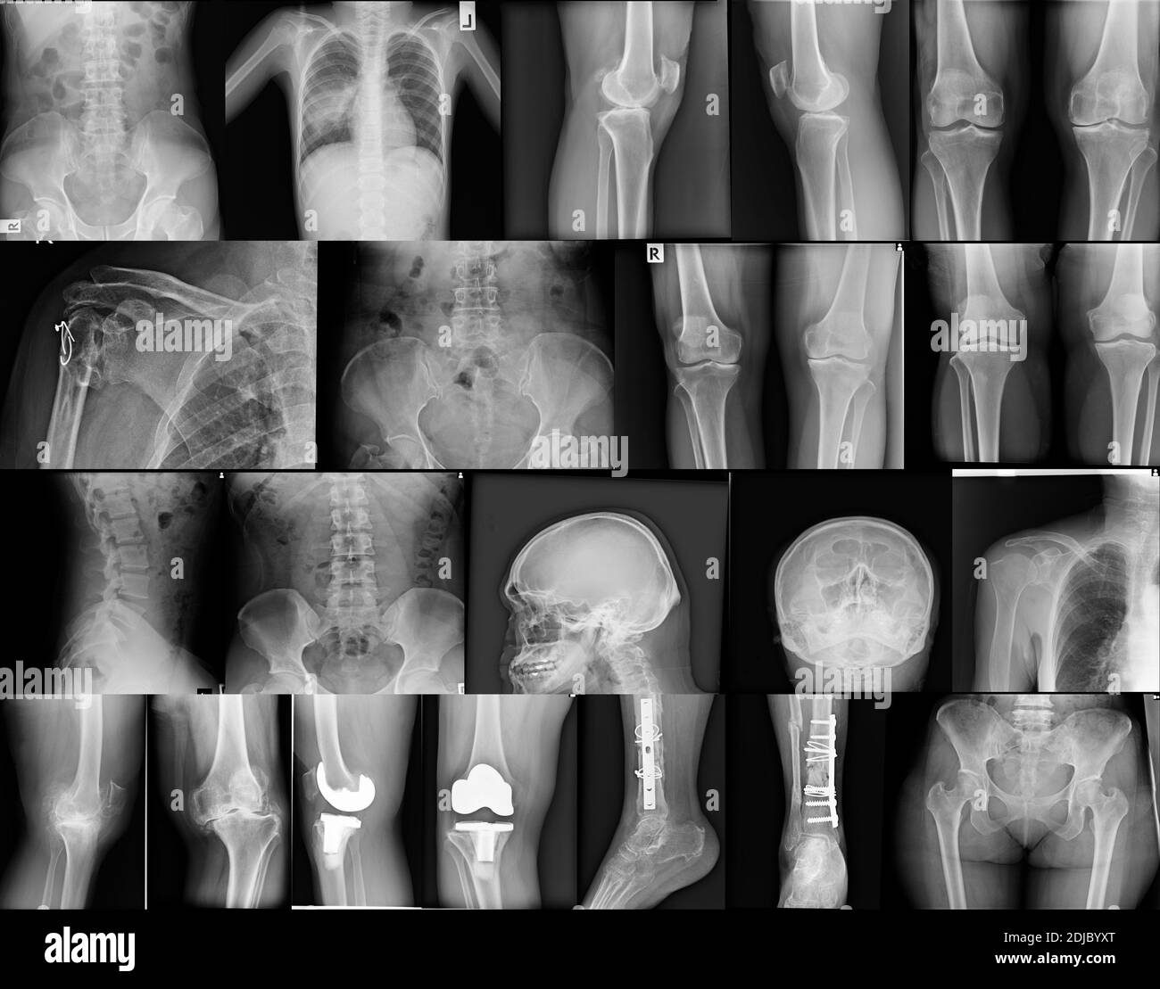 Detail Cyborg Skull X Ray Nomer 29