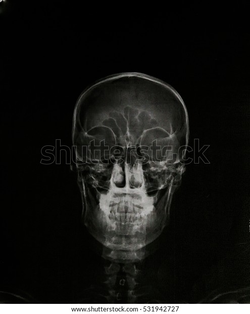 Detail Cyborg Skull X Ray Nomer 36