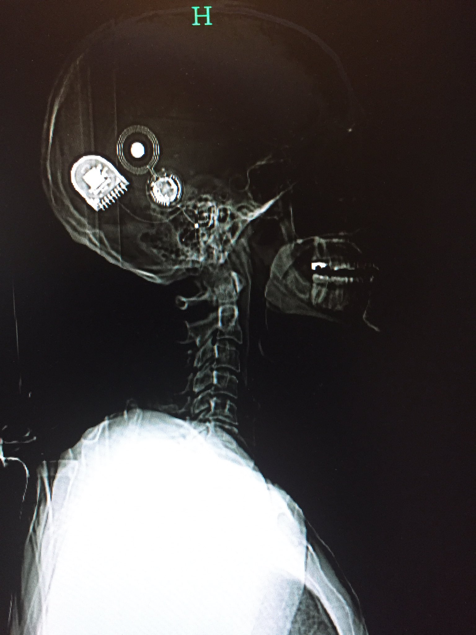 Detail Cyborg Skull X Ray Nomer 39