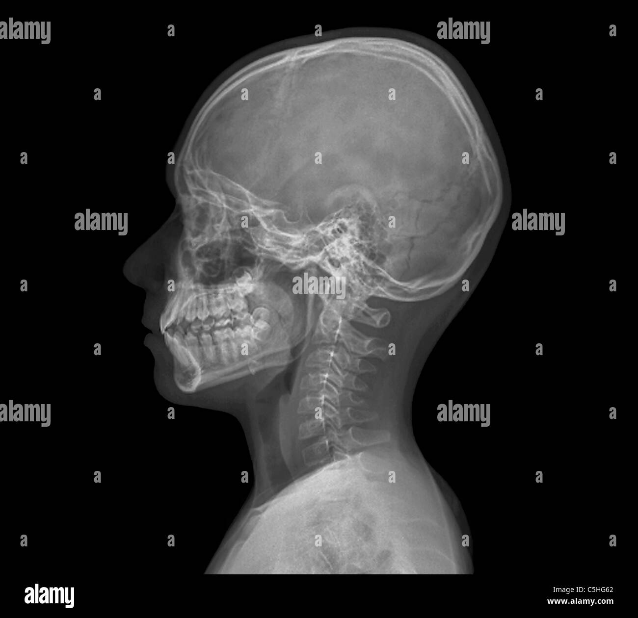 Detail Cyborg Skull X Ray Nomer 53