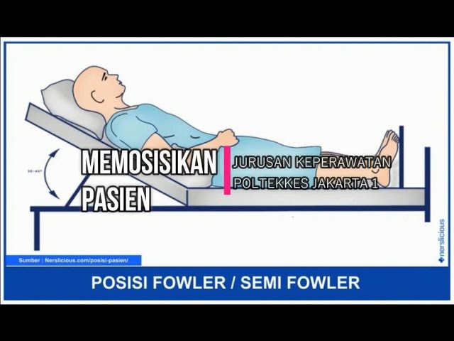 Detail Gambar Posisi Fowler Nomer 15