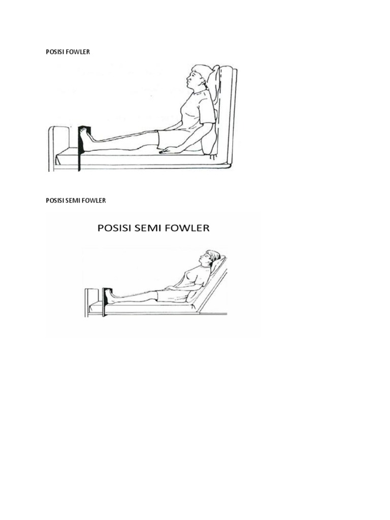 Detail Gambar Posisi Fowler Nomer 16