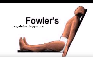 Detail Gambar Posisi Fowler Nomer 20