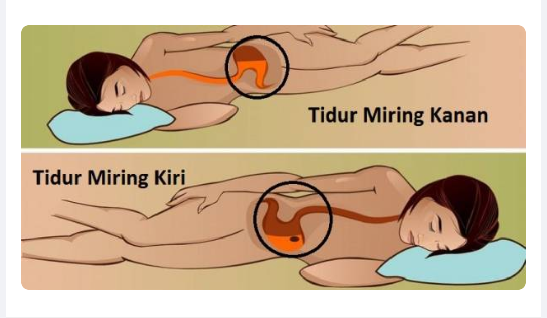 Detail Gambar Posisi Tidur Yang Baik Nomer 30