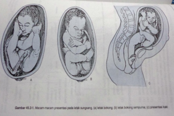 Detail Gambar Presentasi Puncak Kepala Nomer 9