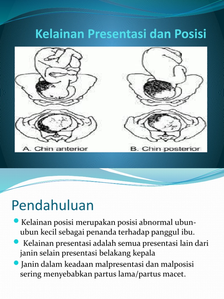 Detail Gambar Presentasi Puncak Kepala Nomer 40