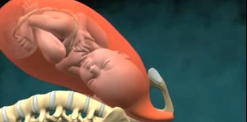 Detail Gambar Proses Bayi Lahir Nomer 44
