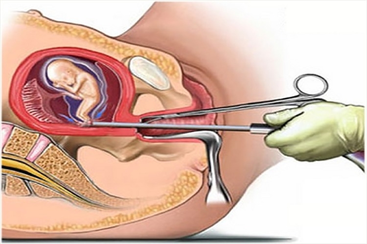 Detail Gambar Proses Bayi Lahir Nomer 49