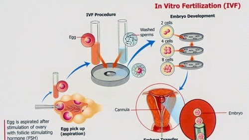 Detail Gambar Proses Bayi Tabung Nomer 17