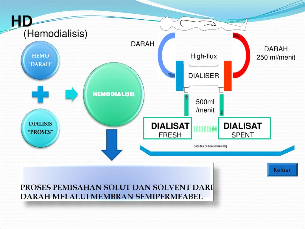 Detail Gambar Proses Dialisis Nomer 21