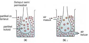 Detail Gambar Proses Dialisis Nomer 28