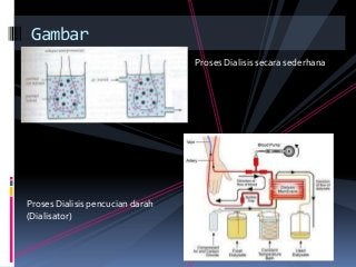 Detail Gambar Proses Dialisis Nomer 37