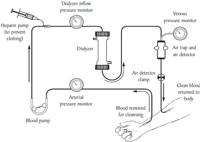 Detail Gambar Proses Dialisis Nomer 48