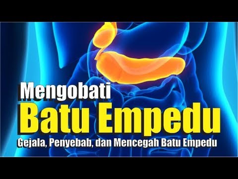 Detail Gambar Proses Keluarnya Batu Empedu Nomer 4