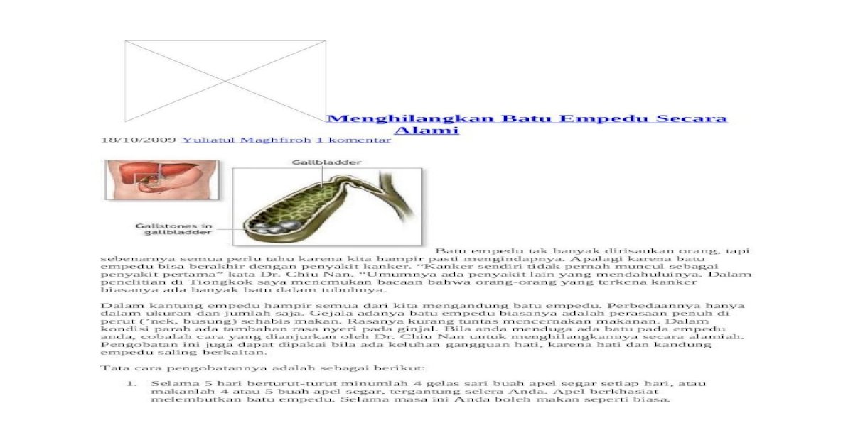 Detail Gambar Proses Keluarnya Batu Empedu Nomer 48
