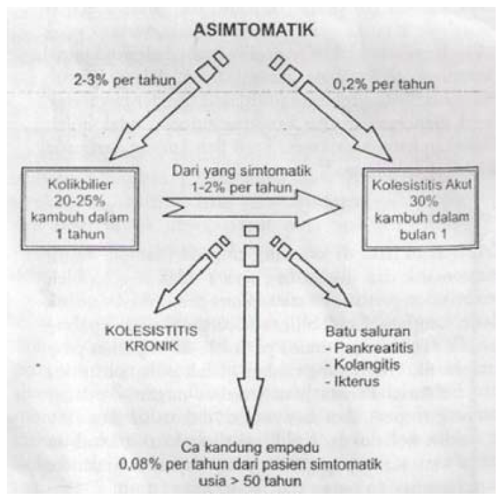 Detail Gambar Proses Keluarnya Batu Empedu Nomer 54