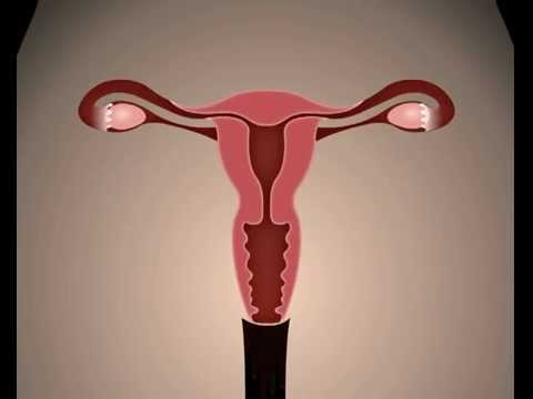 Detail Gambar Proses Menstruasi Nomer 47