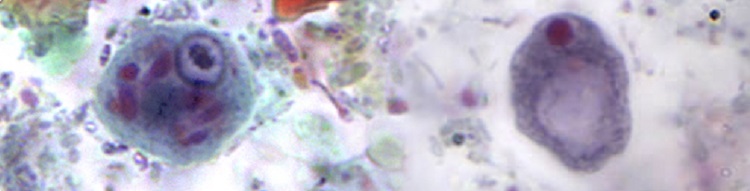 Detail Gambar Protozoa Protozoa Nomer 50