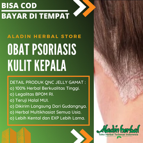 Detail Gambar Psoriasis Kulit Kepala Nomer 47