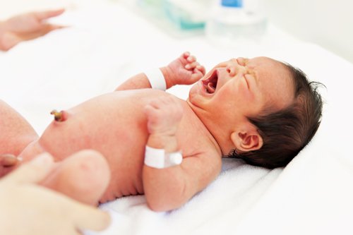 Detail Gambar Pusar Bayi Yang Infeksi Nomer 16