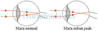 Detail Gambar Rabun Jauh Nomer 15