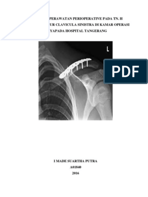 Detail Gambar Radiologi Fraktur Klavikula Nomer 17