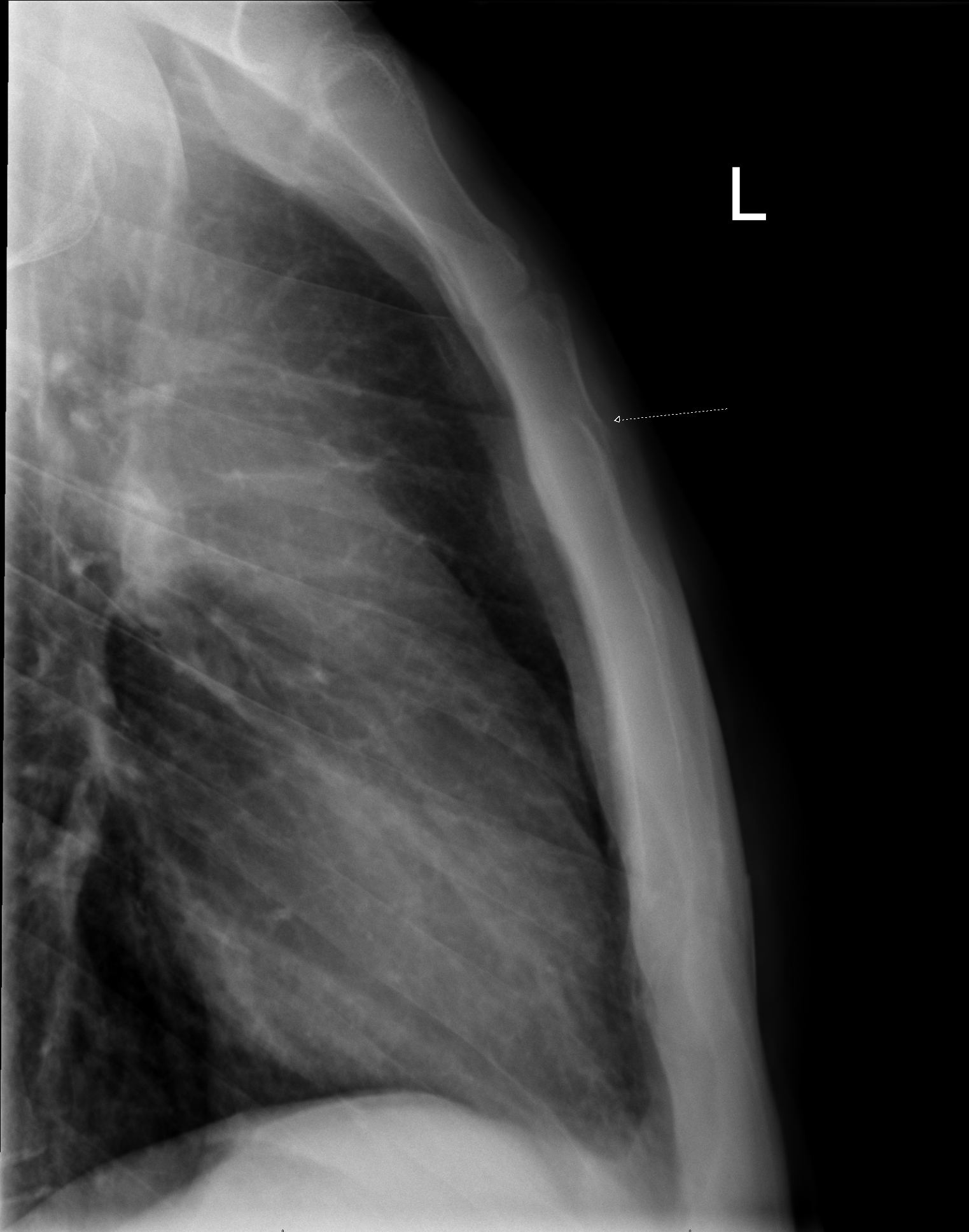 Detail Gambar Radiologi Trauma Sternum Nomer 16