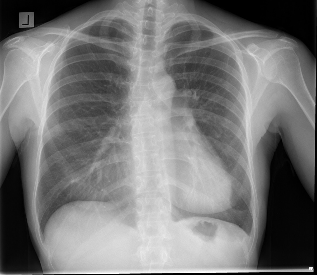 Detail Gambar Radiologi Trauma Sternum Nomer 21