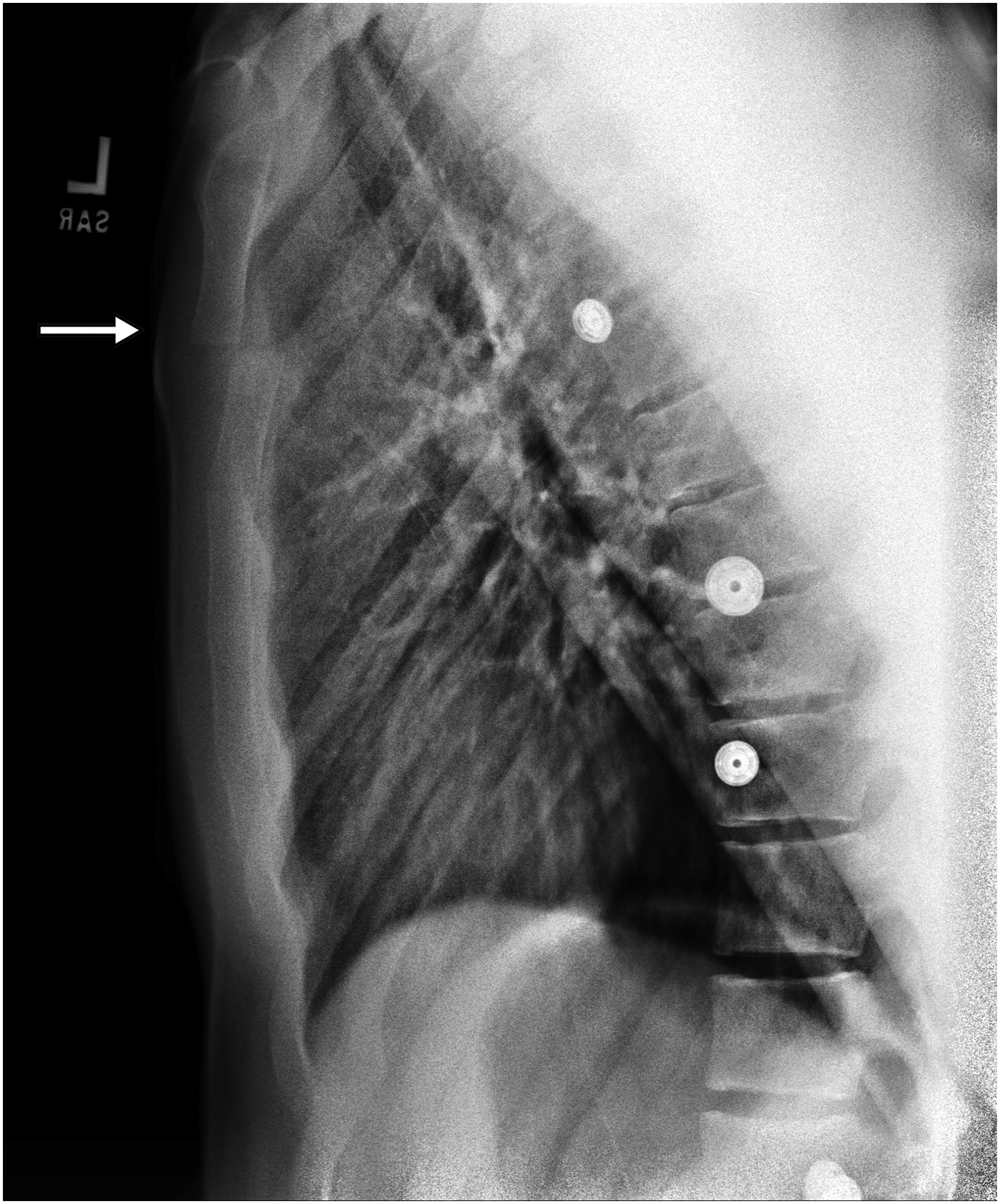Detail Gambar Radiologi Trauma Sternum Nomer 23
