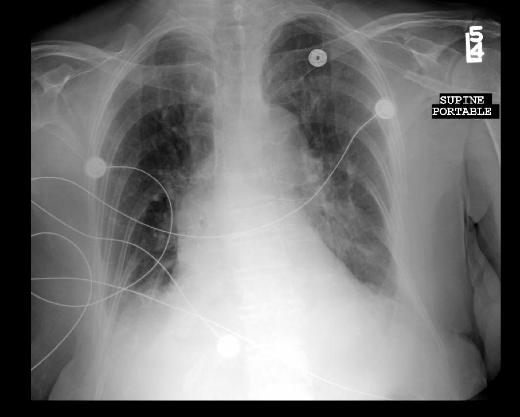 Detail Gambar Radiologi Trauma Sternum Nomer 27