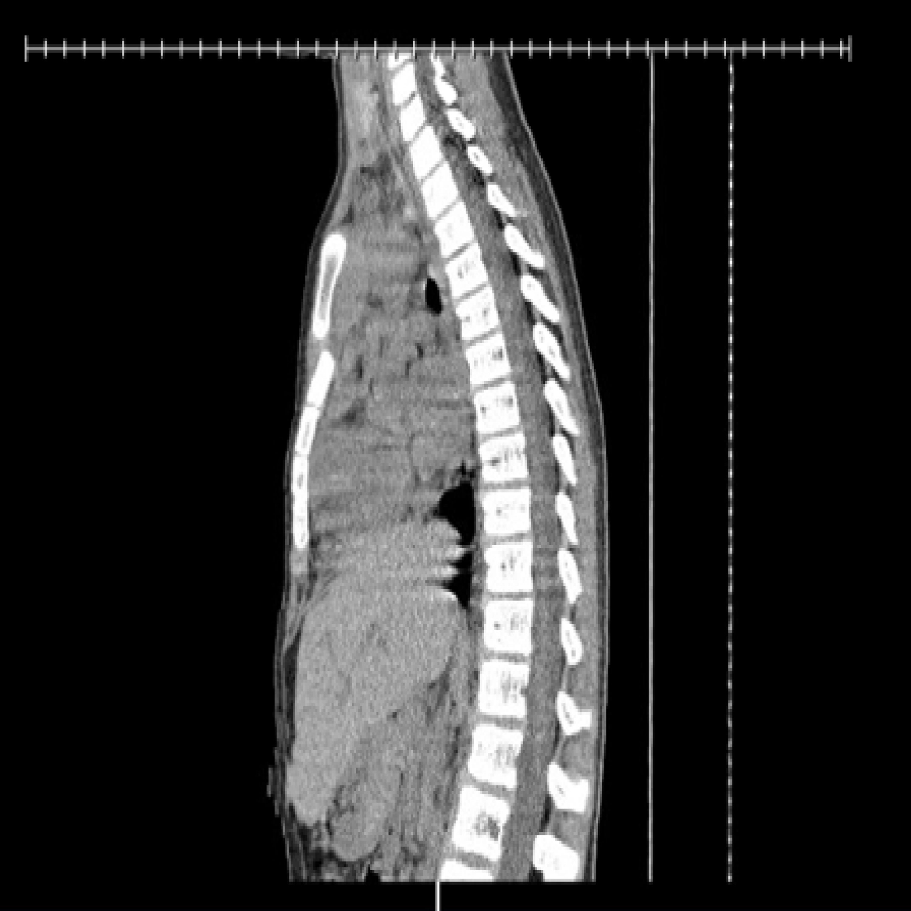 Detail Gambar Radiologi Trauma Sternum Nomer 33