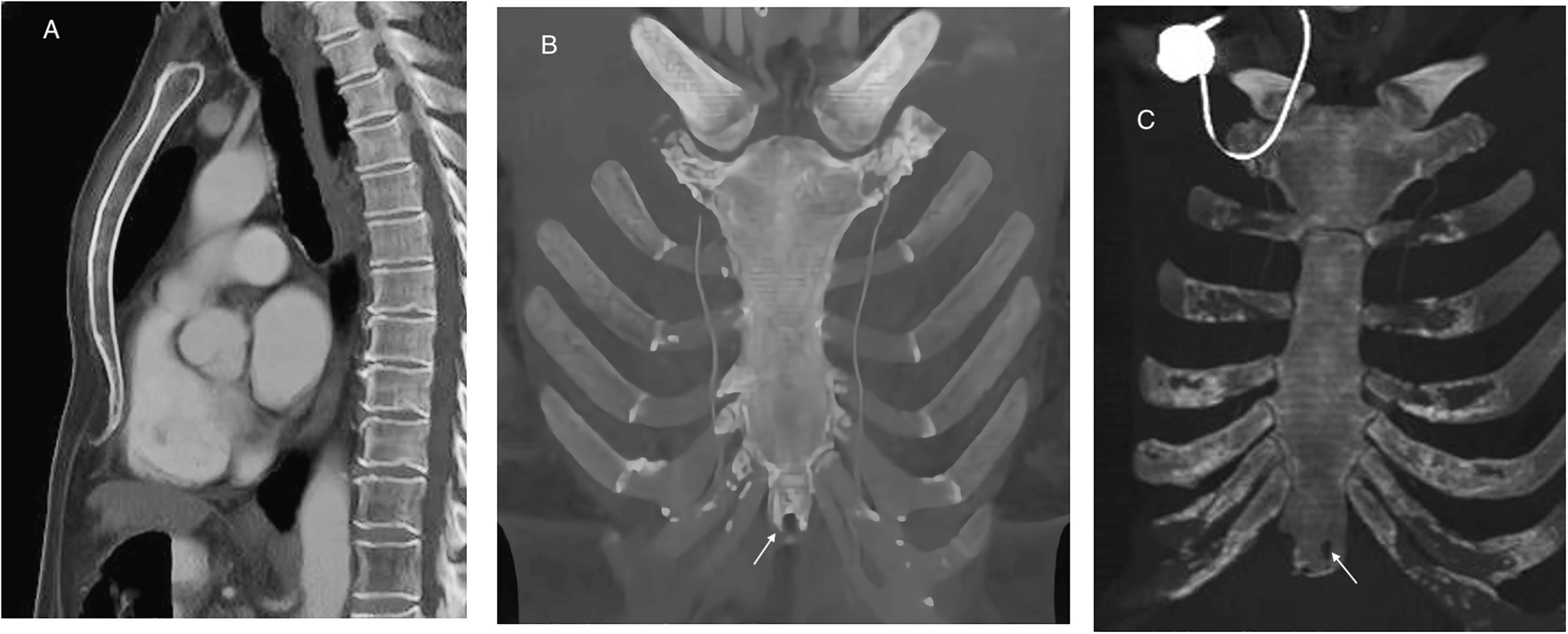 Detail Gambar Radiologi Trauma Sternum Nomer 38