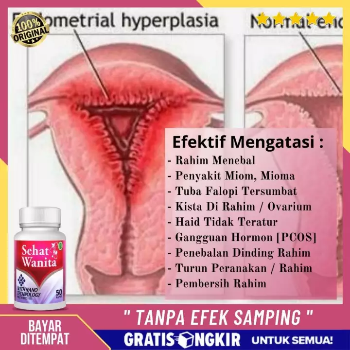 Detail Gambar Rahim Bengkak Nomer 7