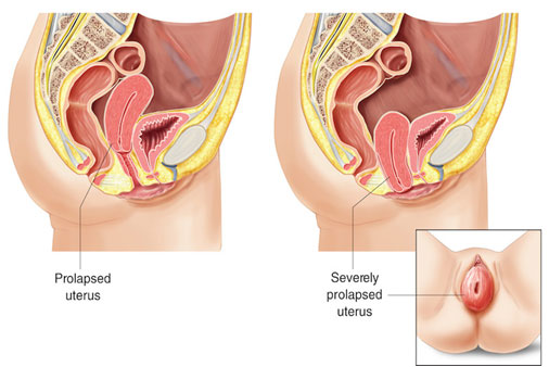 Detail Gambar Rahim Jauh Nomer 43