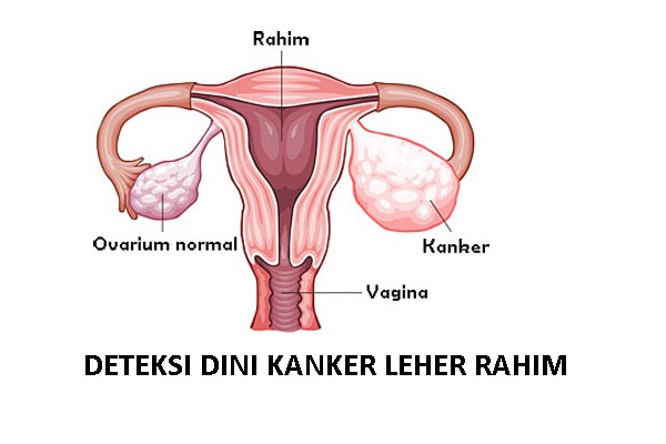 Detail Gambar Rahim Normal Nomer 38