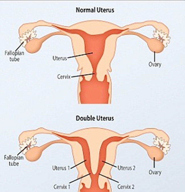 Detail Gambar Rahim Normal Nomer 40