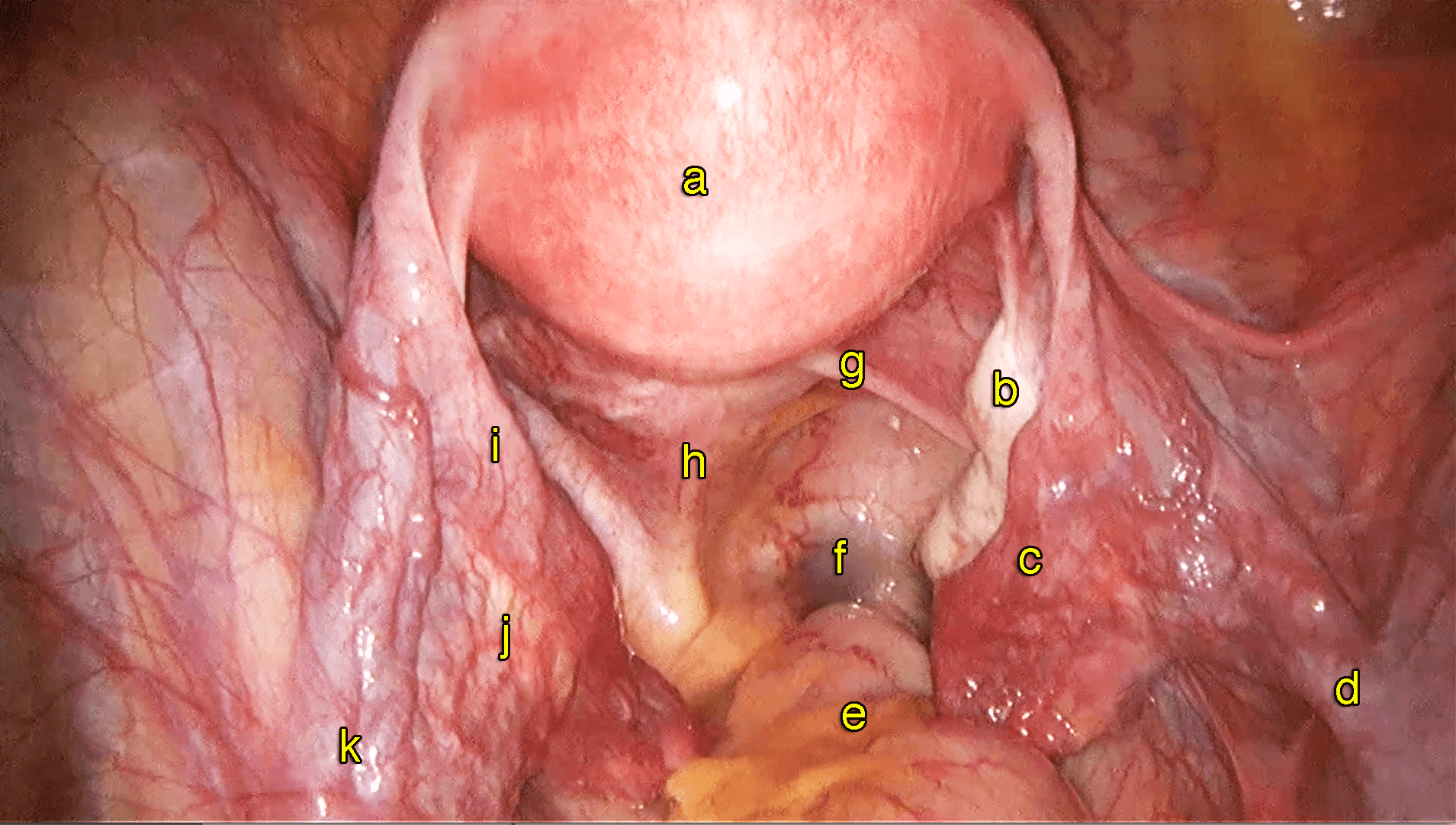 Detail Gambar Rahim Normal Nomer 7