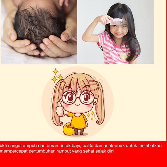 Detail Gambar Rambut Bersih Dan Sehat Kartun Nomer 43