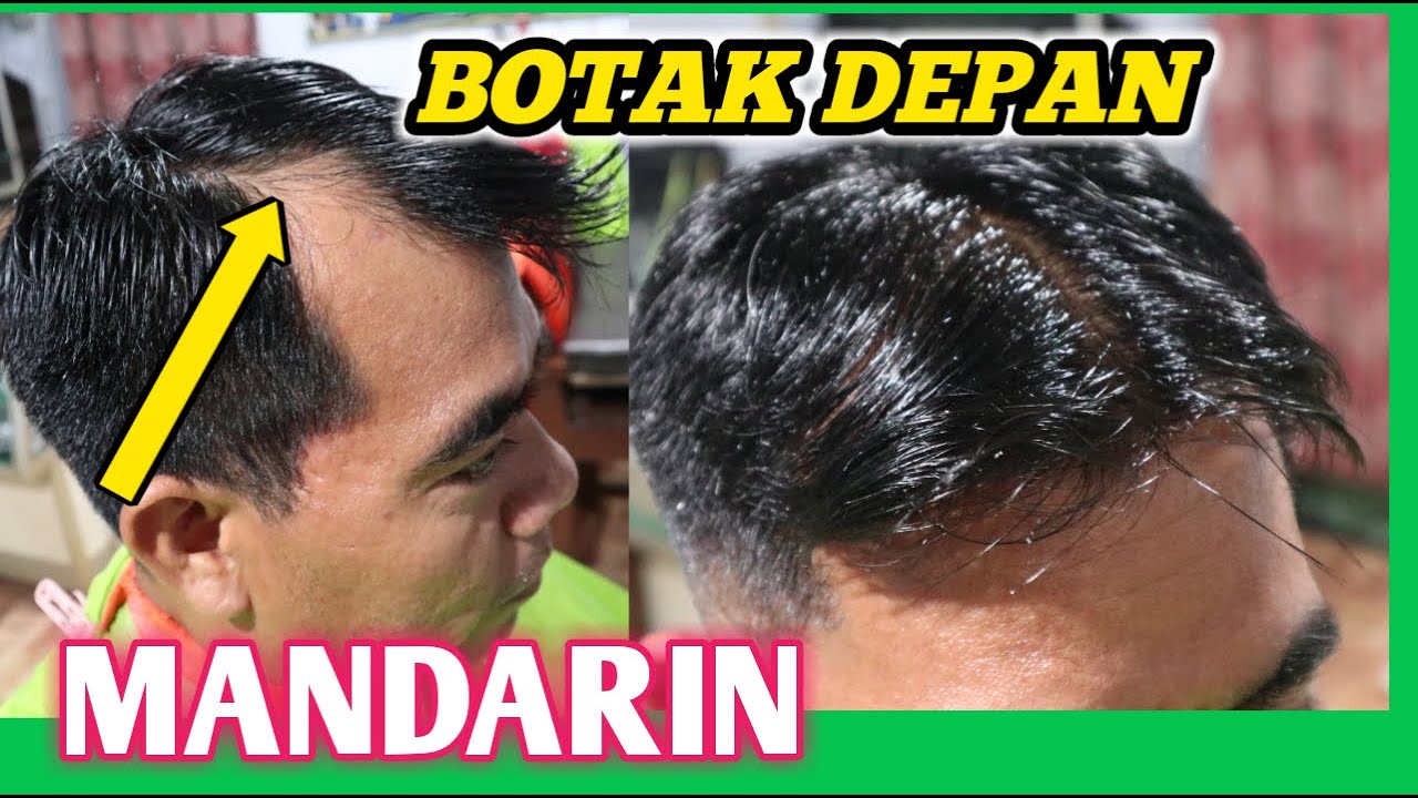 Detail Gambar Rambut Botak Nomer 40