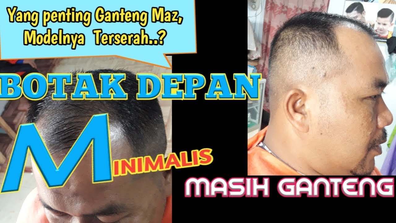 Detail Gambar Rambut Botak Nomer 43