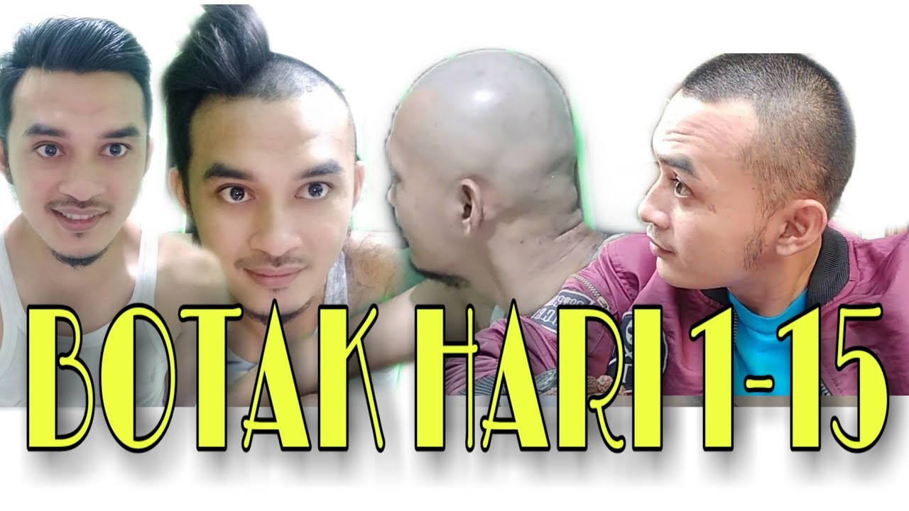 Detail Gambar Rambut Botak Nomer 46