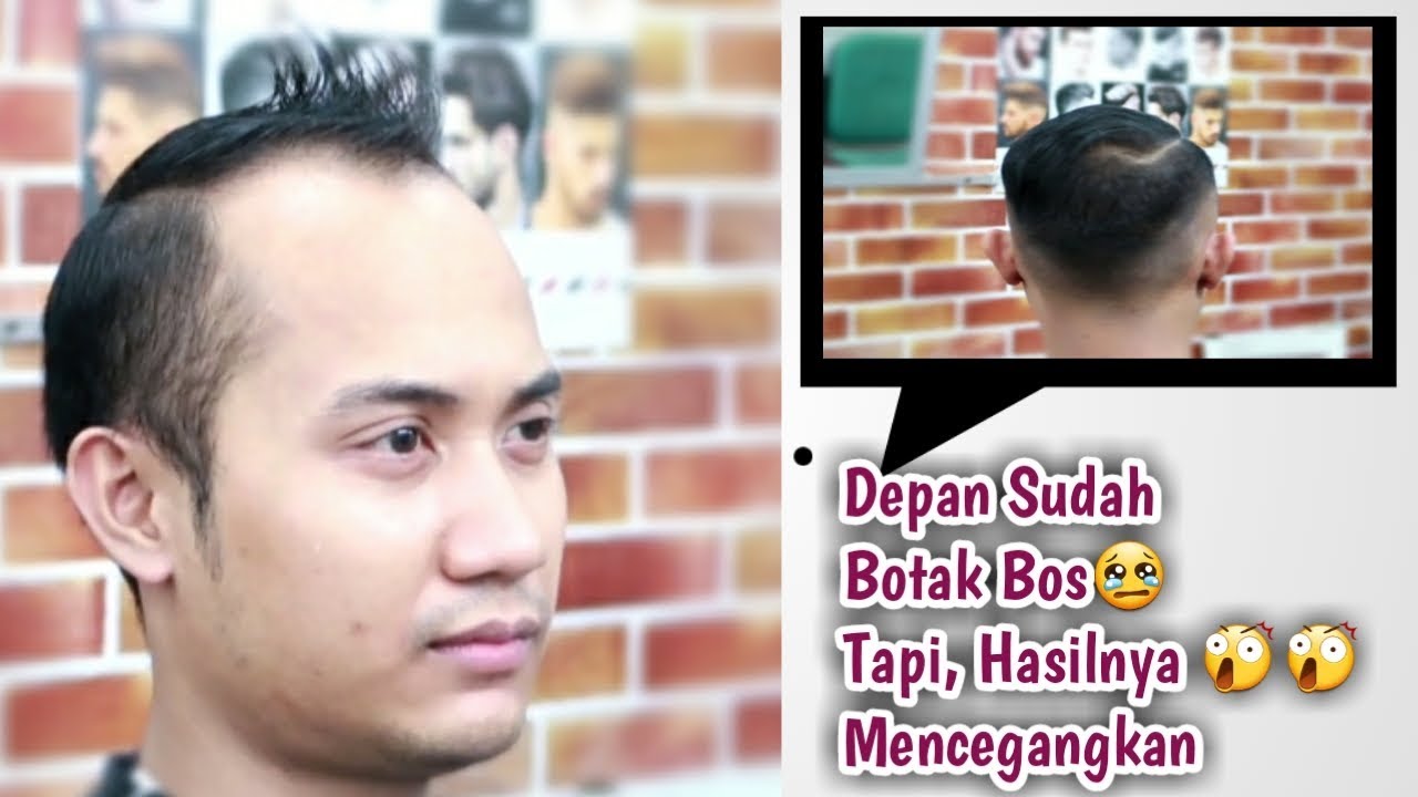 Detail Gambar Rambut Botak Nomer 53