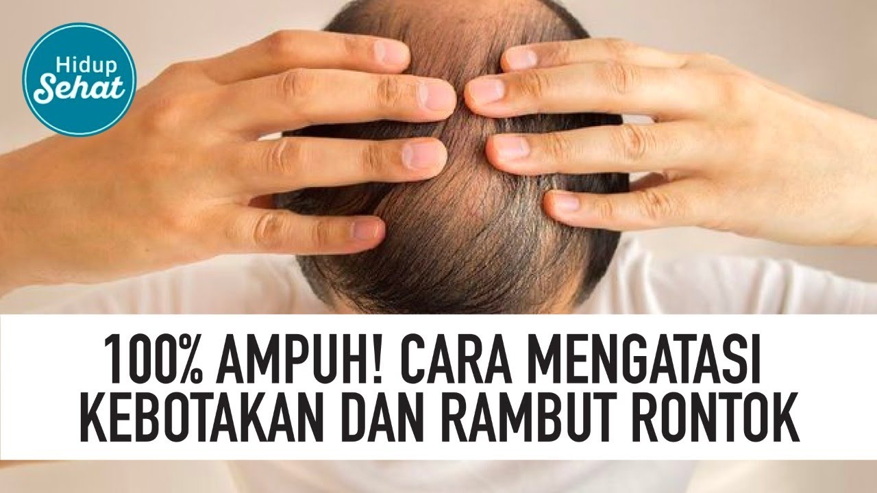 Detail Gambar Rambut Rontok Nomer 46