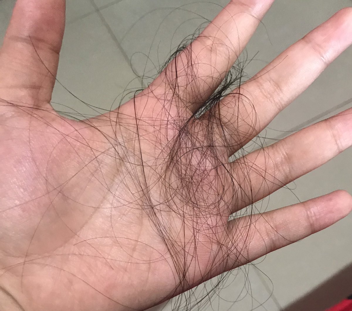 Detail Gambar Rambut Rontok Di Tangan Nomer 2